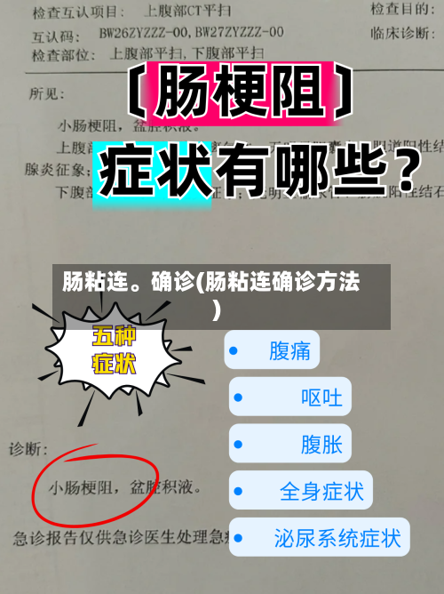 肠粘连。确诊(肠粘连确诊方法)-第3张图片