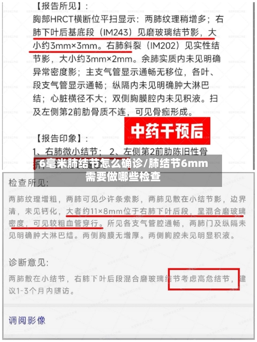 6毫米肺结节怎么确诊/肺结节6mm需要做哪些检查-第2张图片
