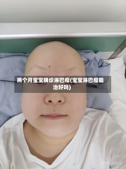两个月宝宝确诊淋巴瘤(宝宝淋巴瘤能治好吗)-第2张图片